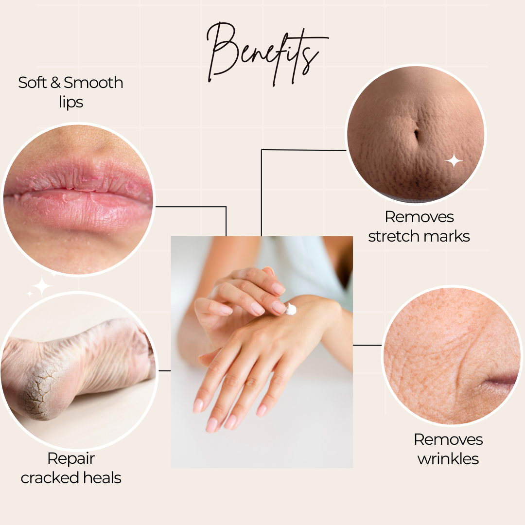 Tatsat Shata Dhauta Ghrita -100 Times Washed Desi Cow A2 Ghee moisturizing cream. Anti-Aging, Removes Stretch Marks & Wrinkles