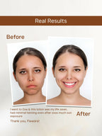 Flawora D-Tan Lotion for Pigmentation & Tan Removal For Dark Spots