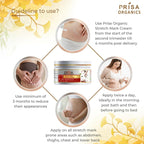 Prisa Organics Stretch Mark Removal Cream To Reduce Stretch Marks, Scars, Spots, Discolouration
