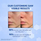 Bella Vita Organic Dry Skin Face Moisturizer