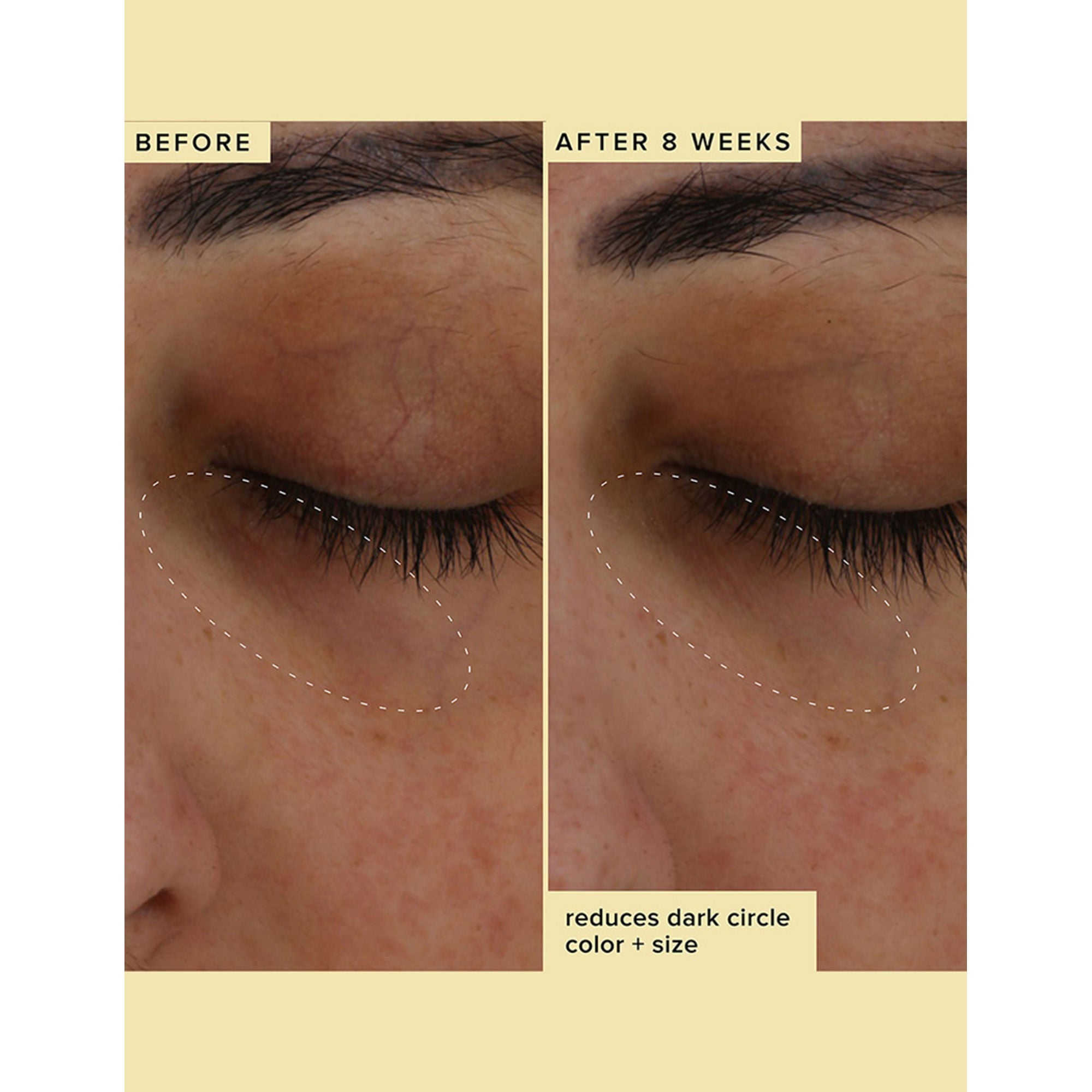 Farmacy Beauty Wake Up Honey Eye Cream