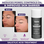 Sanfe 2% BHA Pore Cleansing Toner