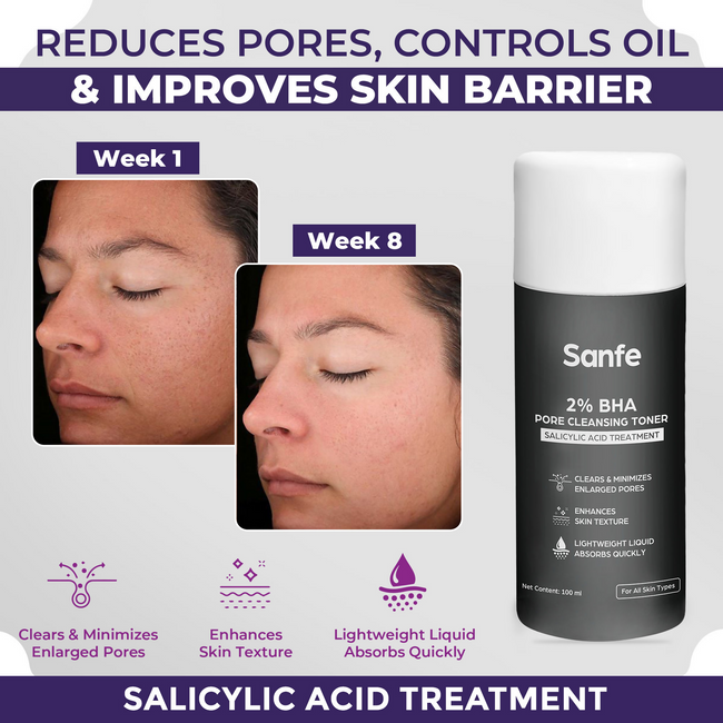 Sanfe 2% BHA Pore Cleansing Toner Main Image
