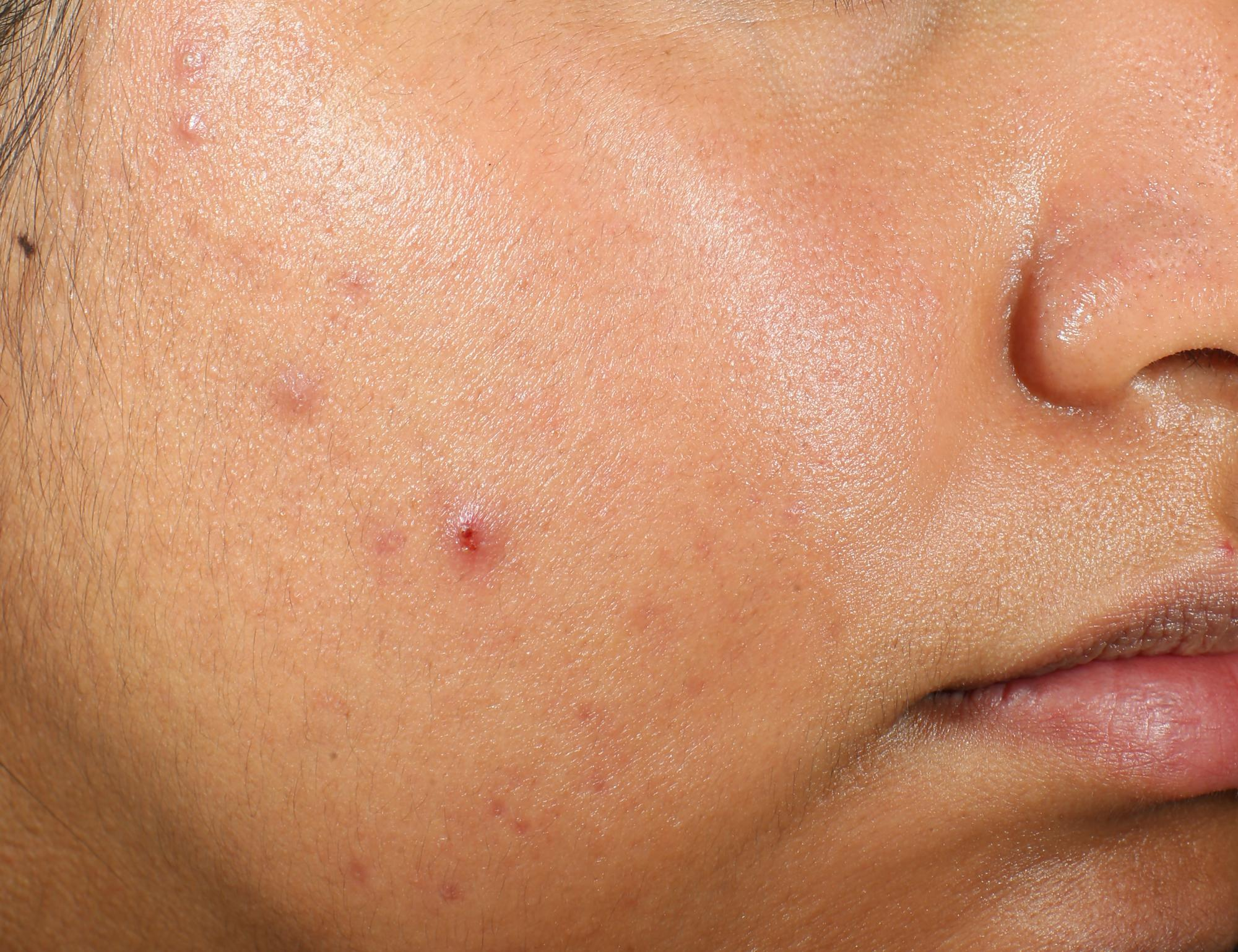 Murad Clarifying Water Gel