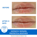 Uriage Bariederm-Cica Protecting Lip Balm For Dry,Cracked & Chapped Lips With Squalane & PHytosterol