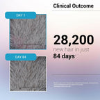 Sotrue Hair Growth Serum With Redensyl 3%, Procapil 3%, Anagain 4% and Baicapil 2% Hair Growth Actives