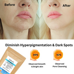 Urbaano Herbal L-Ascorbic Acid (Vitamin C Powder)