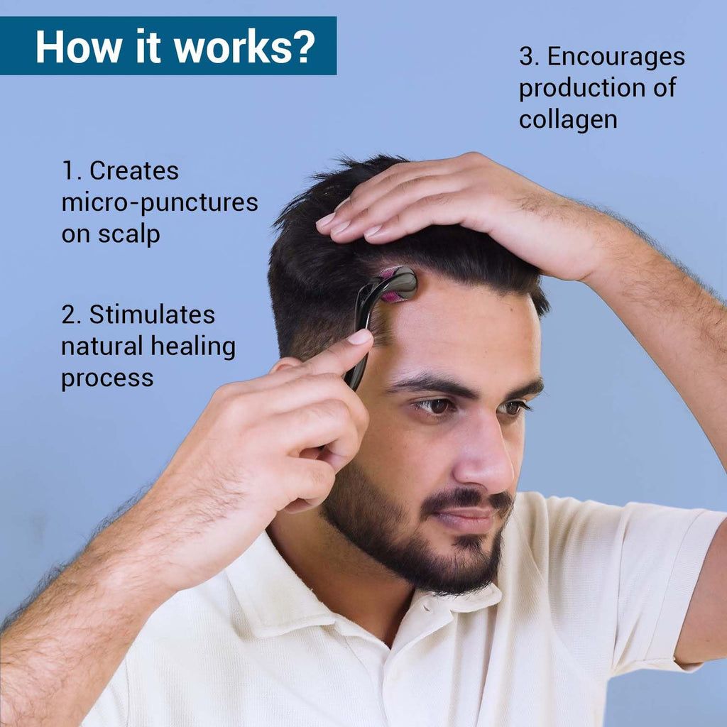 Sotrue Derma Roller For Hair Growth 1 mm with 540 Stainless Steel Needles - Activates Hair Follicles, For Hair Fall & Hair Thickening, Reduces Acne Scars