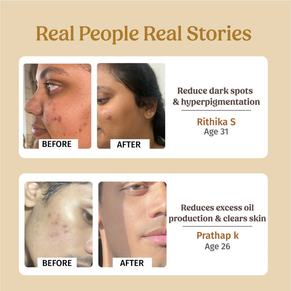 Vilvah Store Skin Hydration Kit