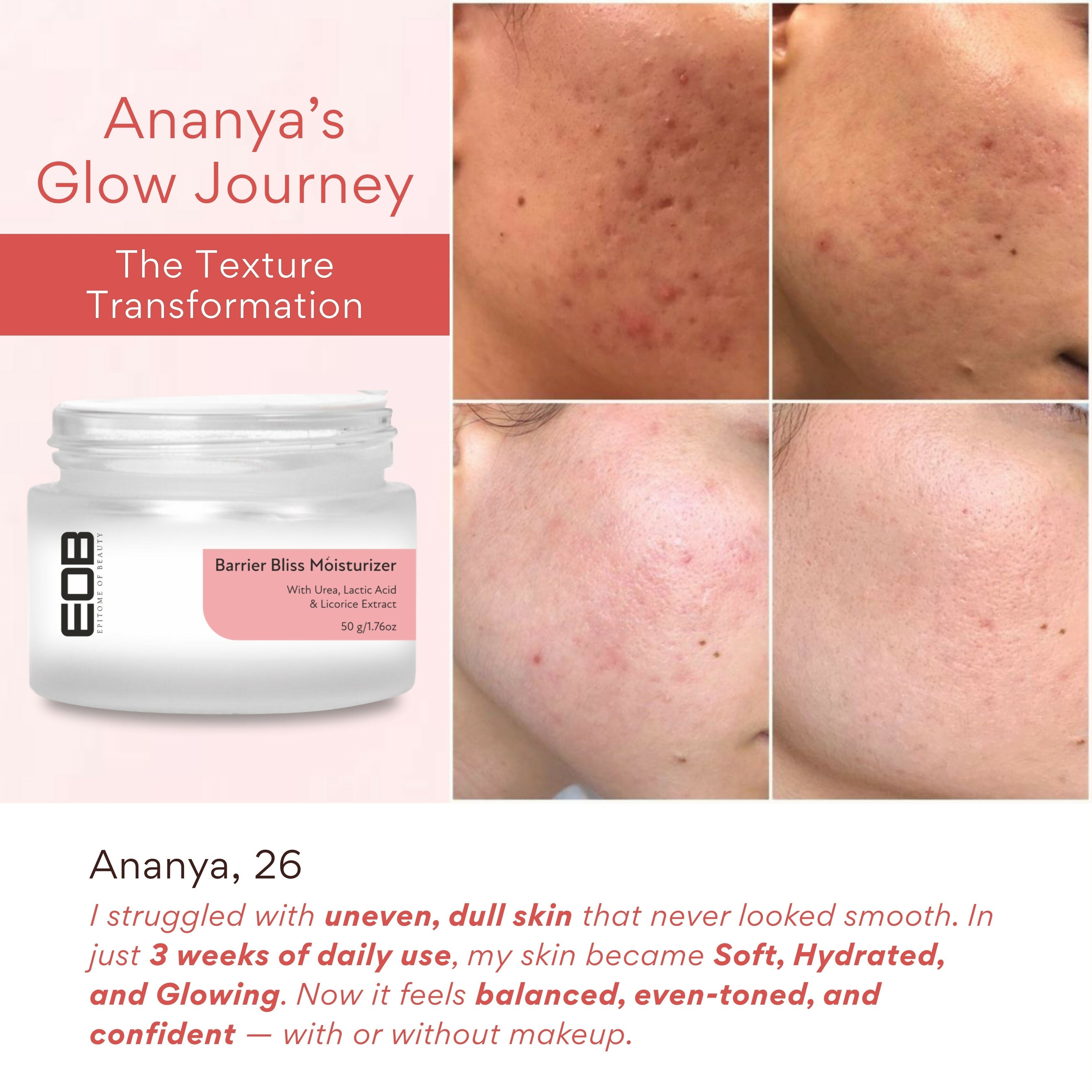 EOB Barrier Bliss Moisturizer