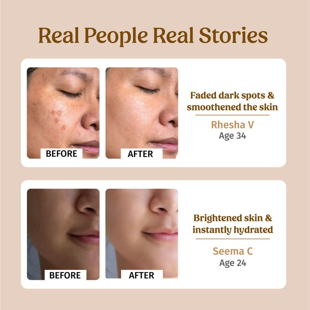 Vilvah Store Ultra Moisturising Cream (Fine lines & Wrinkles)