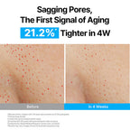 Innisfree 1% Retinol Green Tea VEGAN PDRN Ampoule - Anti-Aging, Brightening & Skin-Soothing Serum