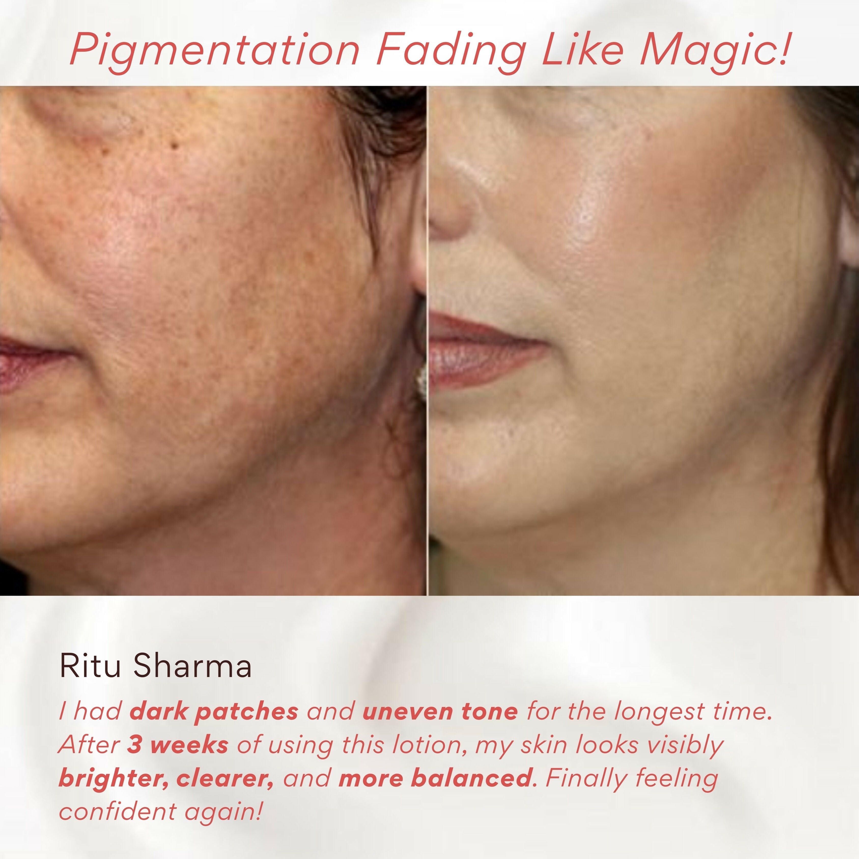 EOB Moisture Glow Lotion for Face & Body