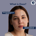 Dermistry 12% Niacinamide 2% Zinc Face Serum For Oil Blemish Control Minimize Pores & Even Skin Tone