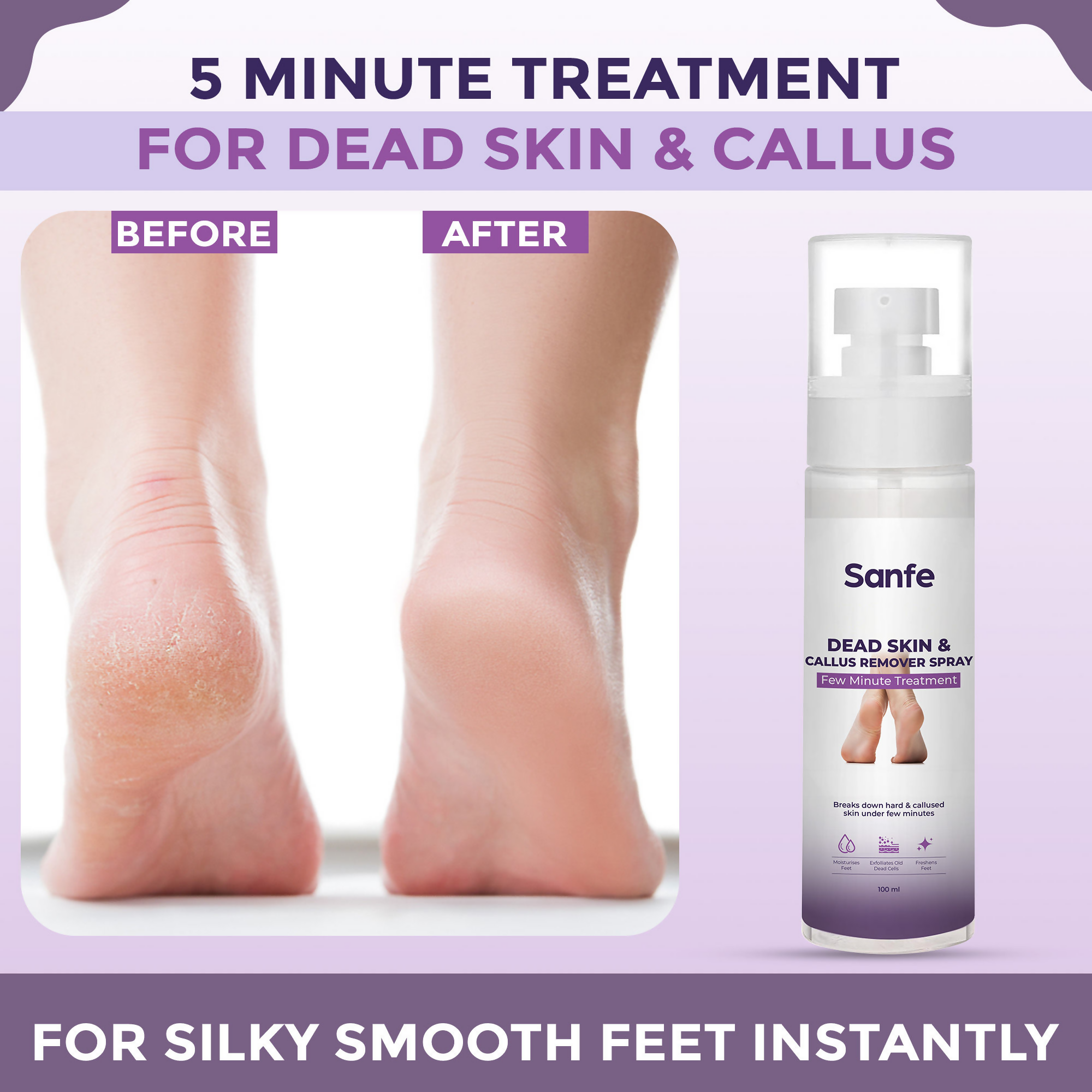 Sanfe Dead Skin & Callus Remover Spray