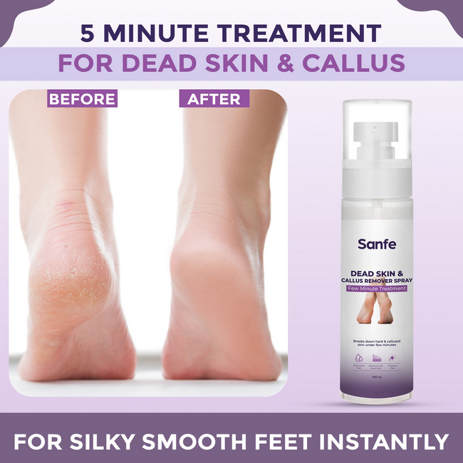 Sanfe Dead Skin & Callus Remover Spray Main Image