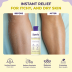 Sanfe 15% Glycerine Lotion For Very Very Dry Skin