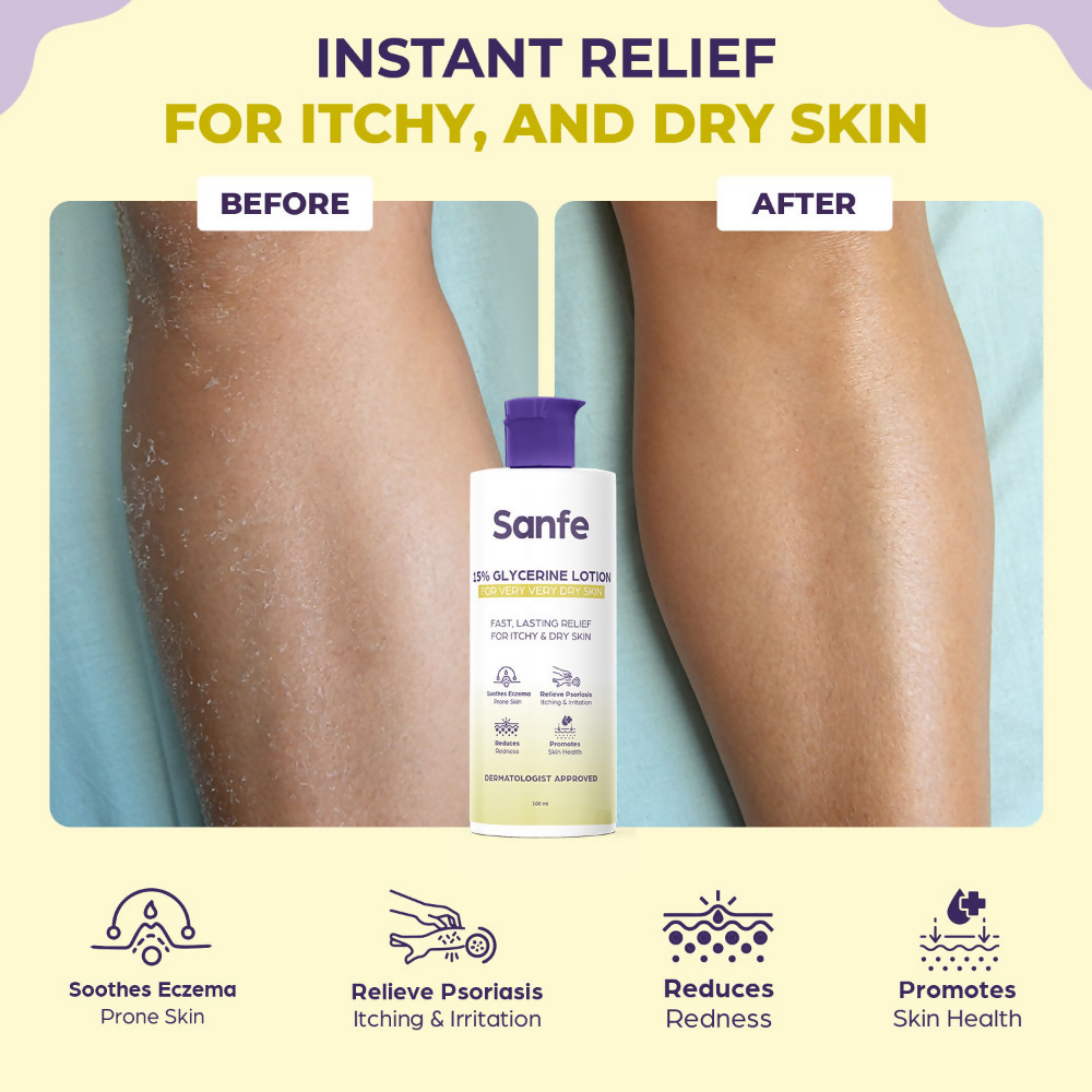 Sanfe 15% Glycerine Lotion For Very Very Dry Skin