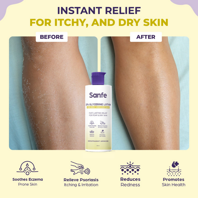 Sanfe 15% Glycerine Lotion For Very Very Dry Skin Main Image