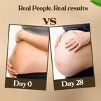 Pokonut Natural Stretch Mark Cream