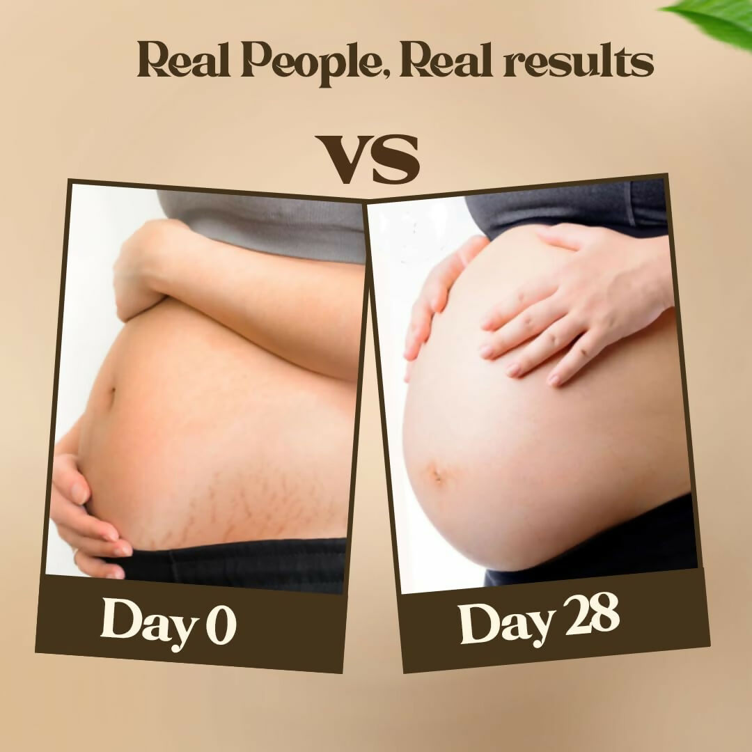 Pokonut Natural Stretch Mark Cream