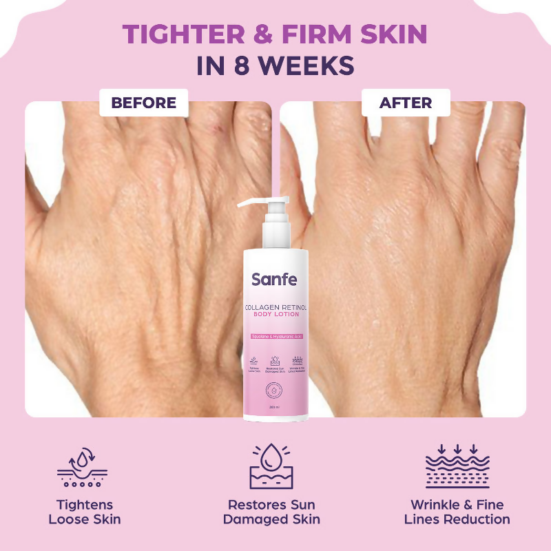 Sanfe Collagen Retinol Body Lotion
