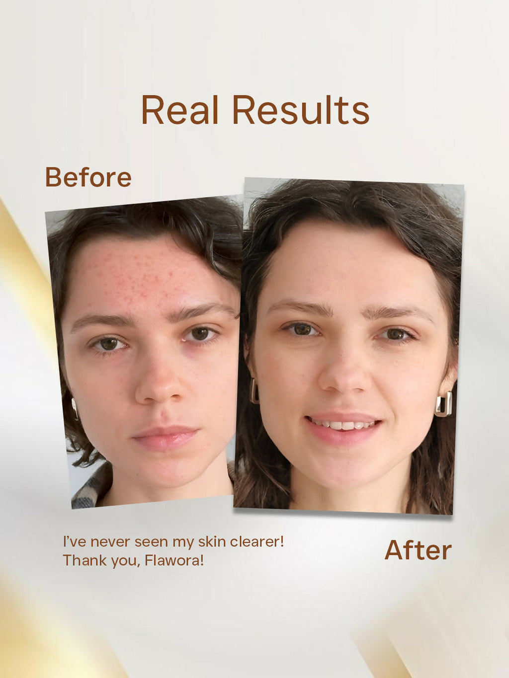 Flawora 24K Gold Face Serum For Brightening, Anti-Aging And Anti Acne Serum To Reduce Blackheads And Open Pores 