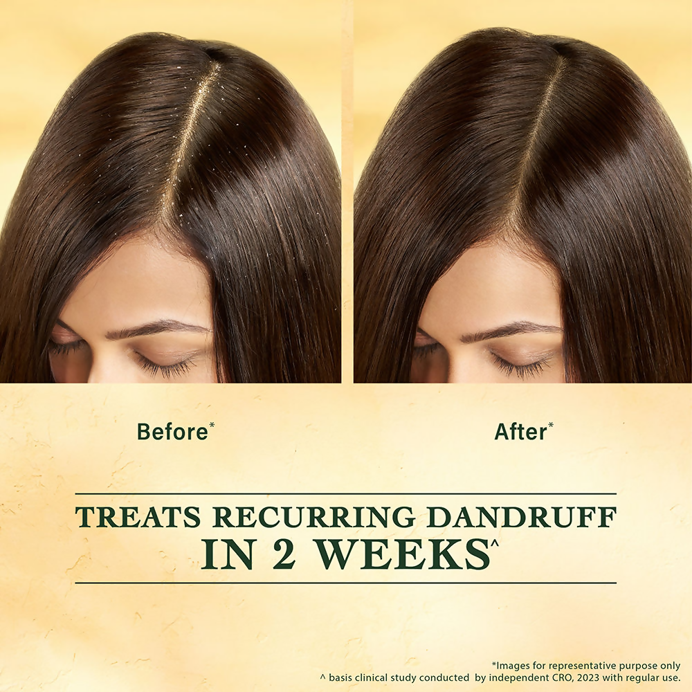 Indulekha Svetakutuja Dandruff Treatment Scalp Serum