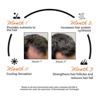 Rootcos Caffeine Hair Fall Control Serum