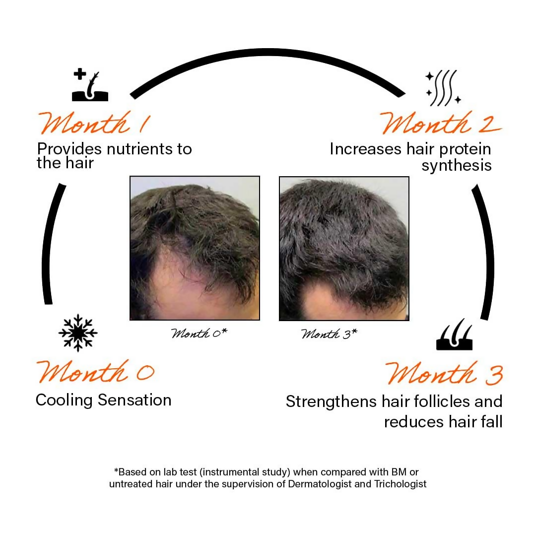 Rootcos Caffeine Hair Fall Control Serum