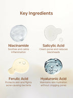 Flawora Anti Acne Serum to reduce Blackheads Open Pores, Excess Oil & Bumpy Texture