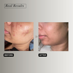 The Formularx Hydra Veil Malazia Hyaluronic Acid Gel Moisturizer