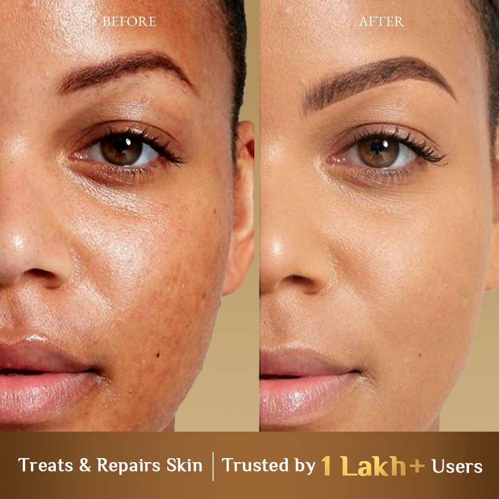 Richfeel Calendula Revitalising Skin Toner