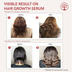 Ivory Natural Serum For Growth Of Hair For New Hair Roots & Encouraging Growth Of Hair