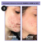 Sereko Niacinamide & Vitamin C Face Toner Spray Mist for Glowing & Brightening Skin