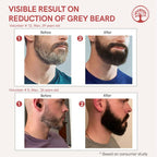 Ivory Natural Greys Beard Serum Restore Natural Black Color Of Grey White Beard