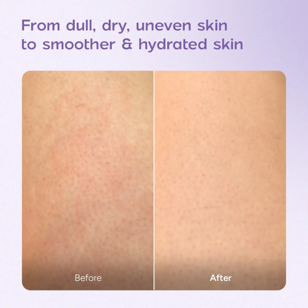 Arata Niacinamide Body Milk for Dull and Dehydrated Skin Main Image