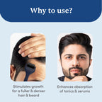 Man Matters Advance Derma Roller For Hair & Beard - 540 Micro 0.5mm Titanium Alloy Needles