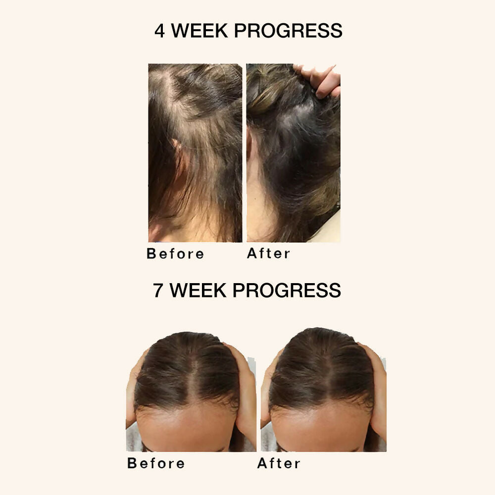 Skog Super Hair Repair