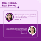 The Derma Co 1% Vitamin C Brightening Lip Balm