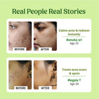 Vilvah Store Aloe Vera Gel (Multi-Purpose Skin & Hair Care)