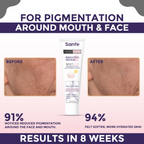 Sanfe Brighten & Repair Spotlite Pigmentation Lightening Cream