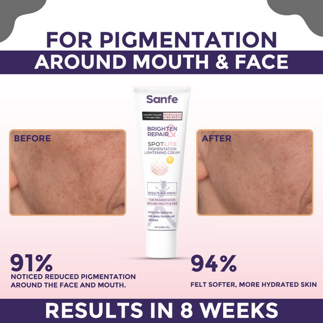 Sanfe Brighten & Repair Spotlite Pigmentation Lightening Cream Main Image