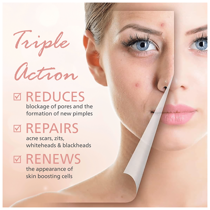 Pearldew Calamine Lotions