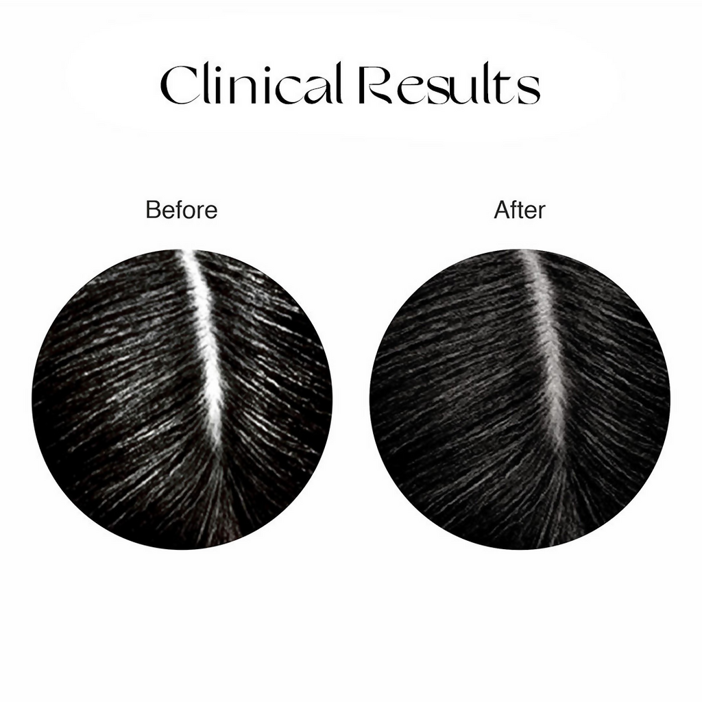 Nourish Mantra Anti-Greying Hair Serum With Rice Water & Arcolys to Stop Premature Hair Greying