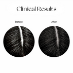 Nourish Mantra Anti-Greying Hair Serum With Rice Water & Arcolys to Stop Premature Hair Greying