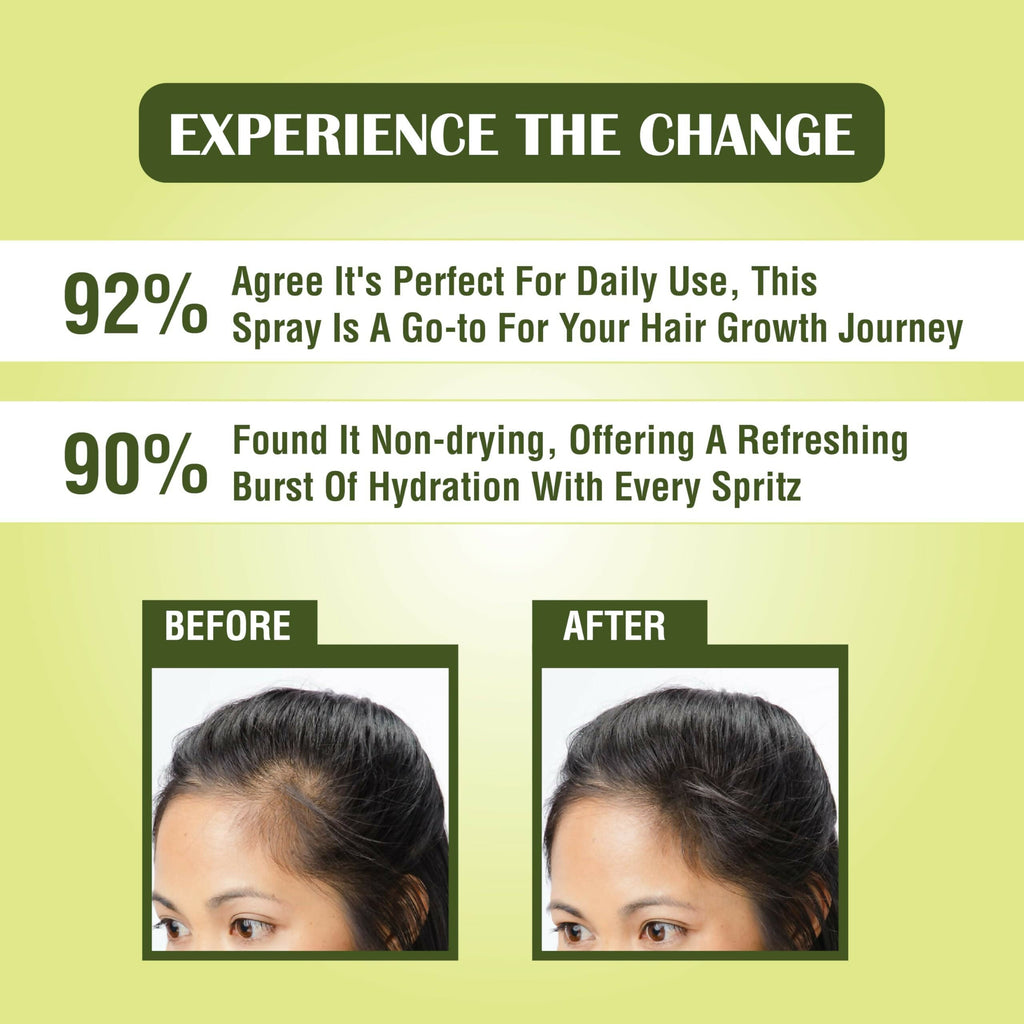 Myherb Rosemary Water Hair Spray For Regrowth, Helps Reduce Hairfall, Strengthens Hair