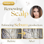 Siya Ayurveda Scalp Exfoliating Serum