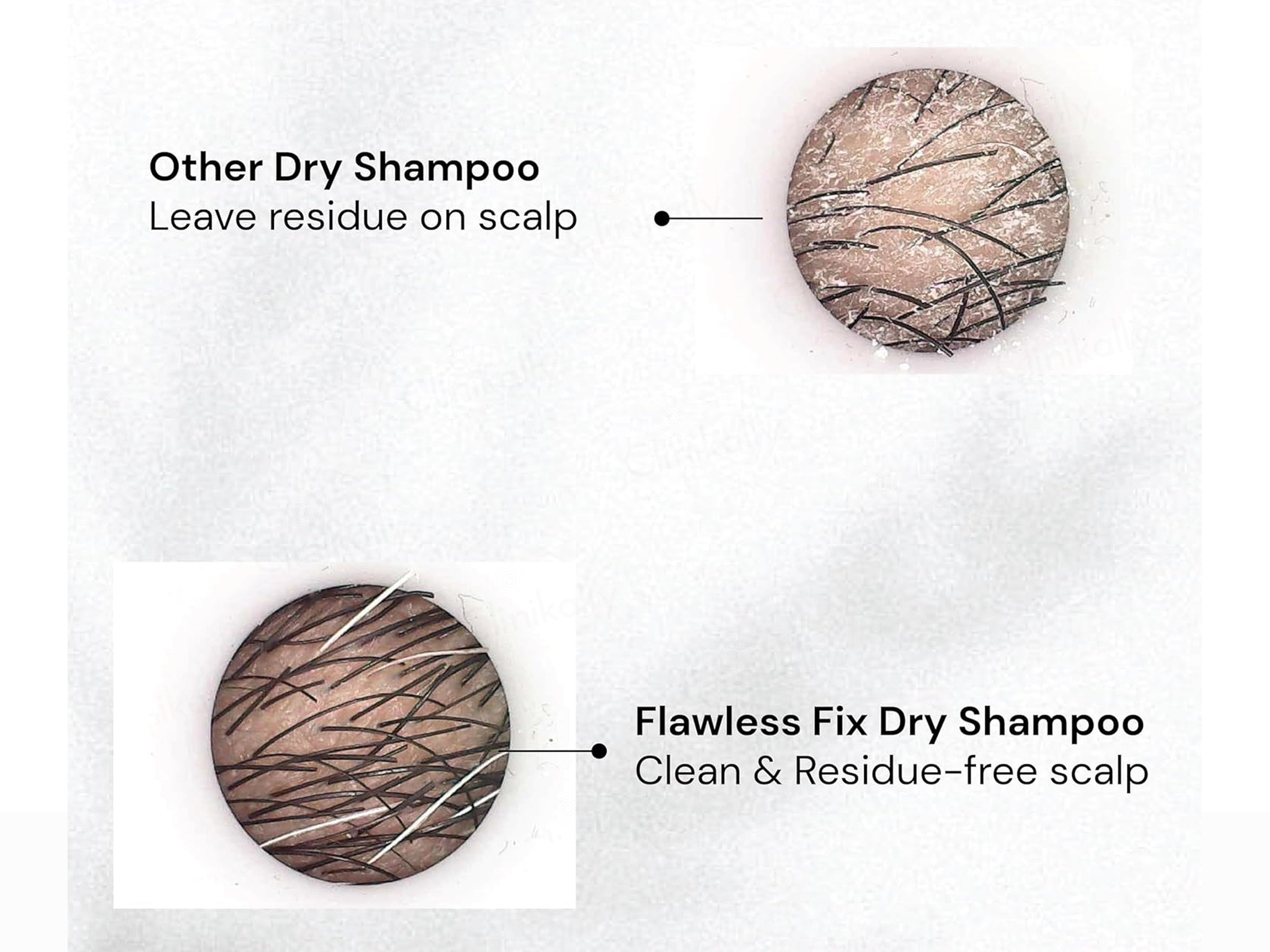 Renewcell Flawless Fix Dry Shampoo