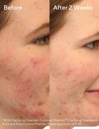 Murad Blemish Control Clarifying Cleanser